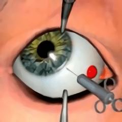 眼科手术医生模拟器中文版